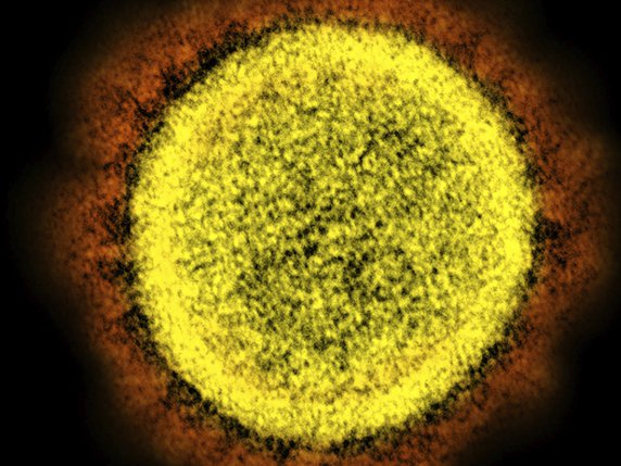 La deuxième vague de la maladie à coronavirus 2019 (Covid-19) est arrivée en Europe (archives). © KEYSTONE/AP